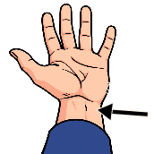 Picture clue