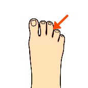 Picture clue